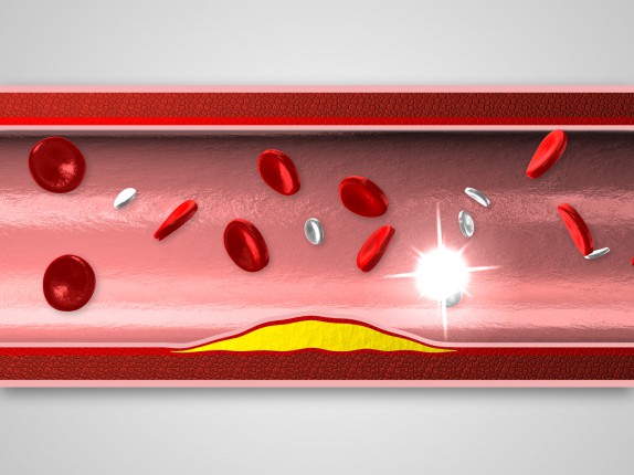 Glenmark / pladizol 3D vizualizace (pladizol04.jpg)