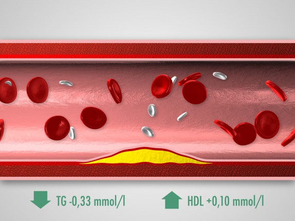 Glenmark / pladizol 3D vizualizace (pladizol02.jpg)