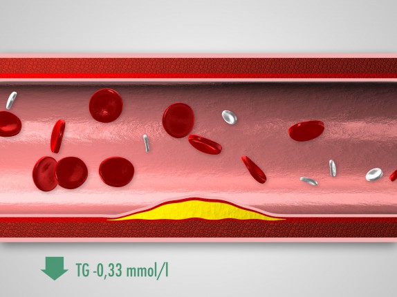 Glenmark / pladizol 3D vizualizace (pladizol03.jpg)