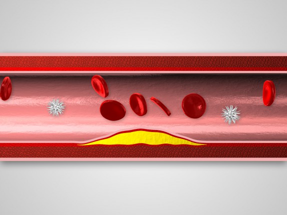 Glenmark / pladizol 3D vizualizace (pladizol06.jpg)