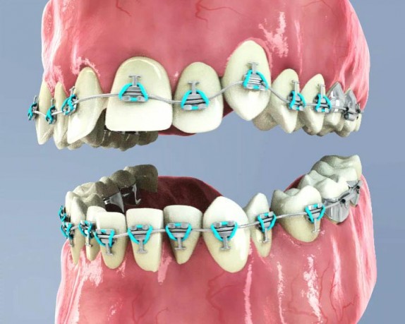 dental care (dentalcare_0000.jpg)