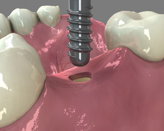 dental care (dentalcare_0002.jpg)
