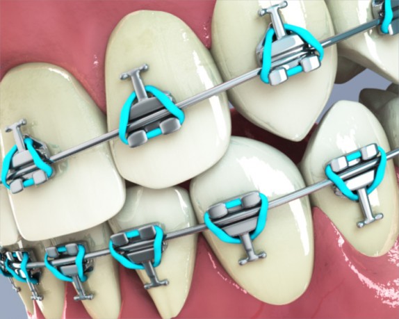 dental care (dentalcare_0005.jpg)
