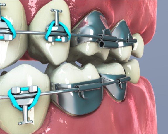 dental care (dentalcare_0007.jpg)