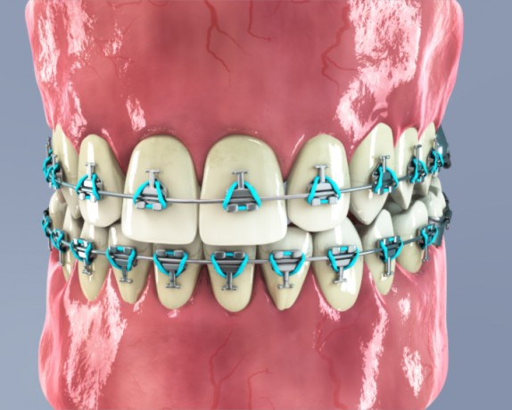 dental care (dentalcare_0008.jpg)