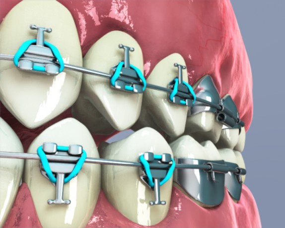 dental care (dentalcare_0010.jpg)