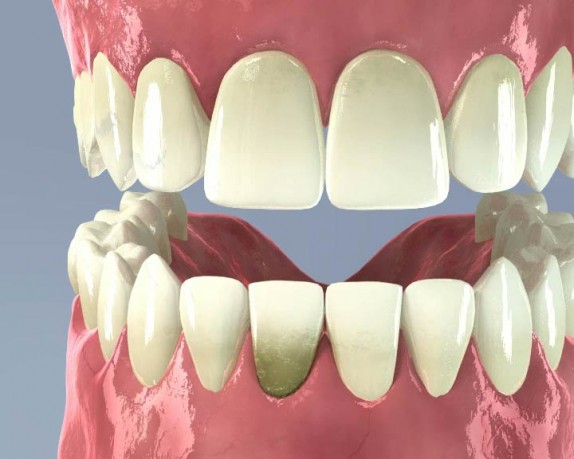 dental care (dentalcare_0012.jpg)