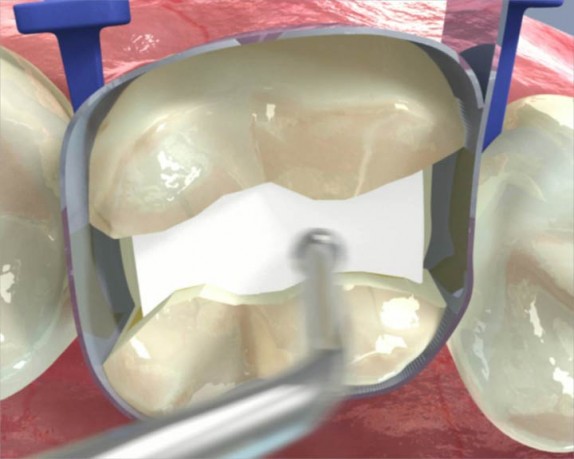 dental care (dentalcare_0015.jpg)
