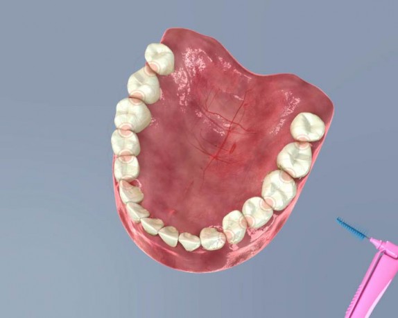 dental care (dentalcare_0016.jpg)