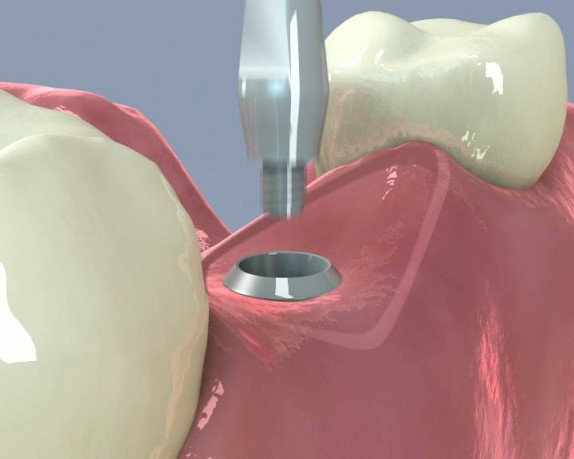 dental care (dentalcare_0018.jpg)