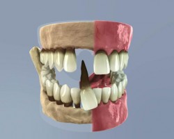 dental care (dentalcare_0019.jpg)