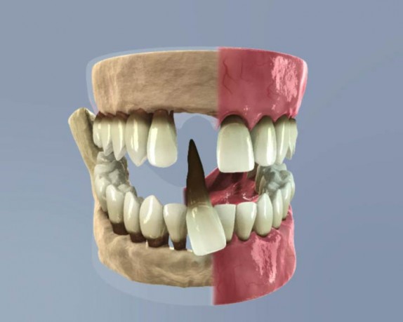dental care (dentalcare_0019.jpg)