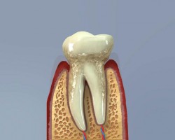 dental care (dentalcare_0020.jpg)