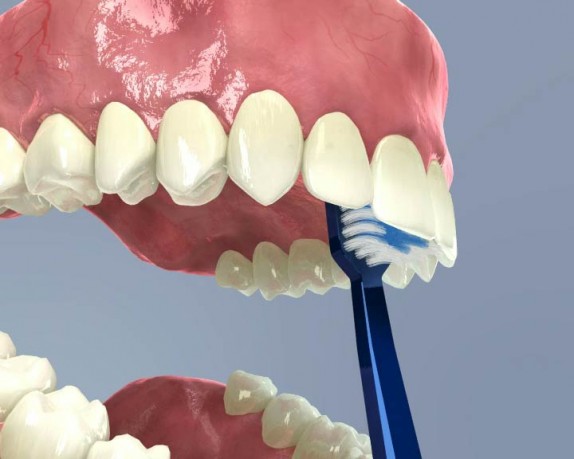 dental care (dentalcare_0021.jpg)