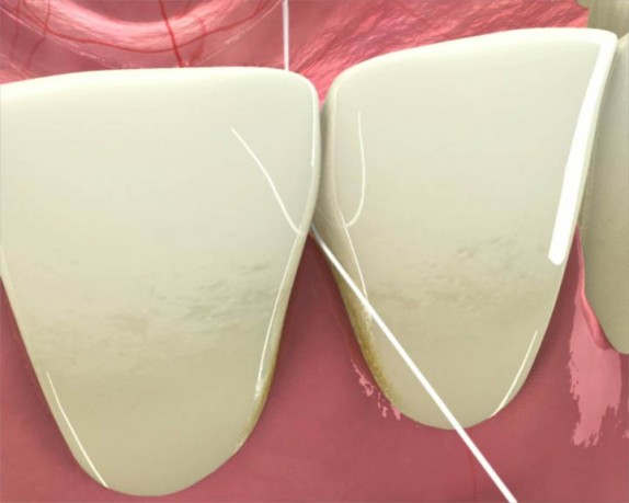 dental care (dentalcare_0022.jpg)