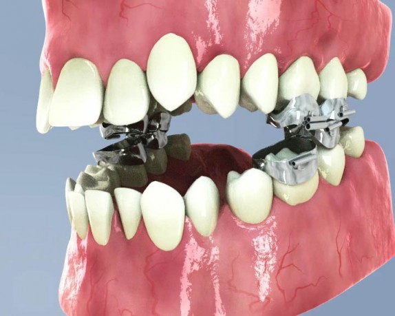 dental care (dentalcare_0023.jpg)