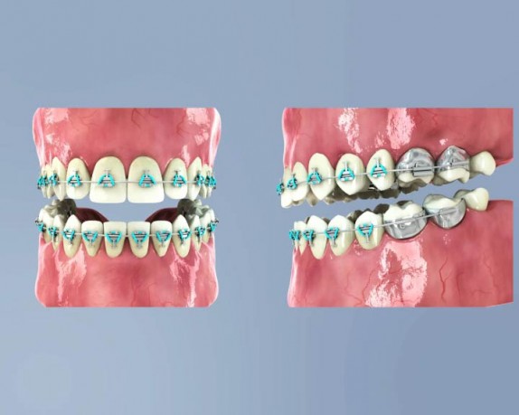 dental care (dentalcare_0025.jpg)