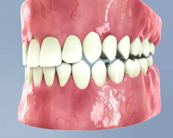dental care (dentalcare_0026.jpg)