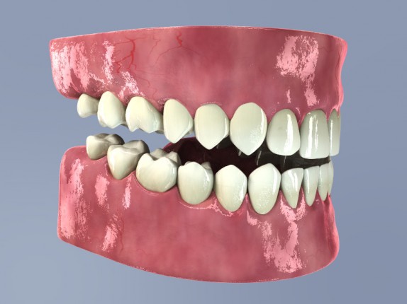 dental care (dentalcare_0027.jpg)
