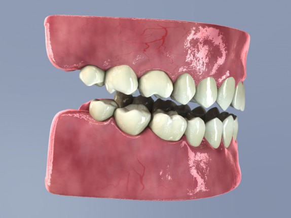 dental care (dentalcare_0028.jpg)