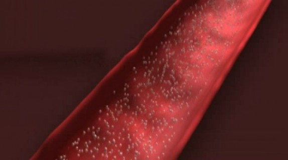 biosynchron (Biosynchron (01642).jpg)